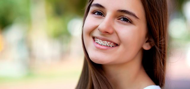 Brackets-para-ninos-640x300-1 Brackets-para-ninos-640x300-1